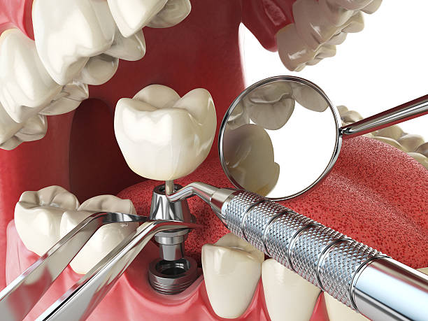 Best Emergency Orthodontic Repairs in Jeffersonville, IN